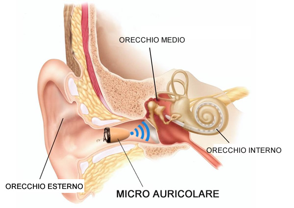 Micro auricolare nell'orecchio